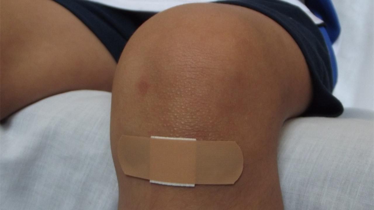 The Multifaceted Miracles of Honey: From Wounds to Wellness